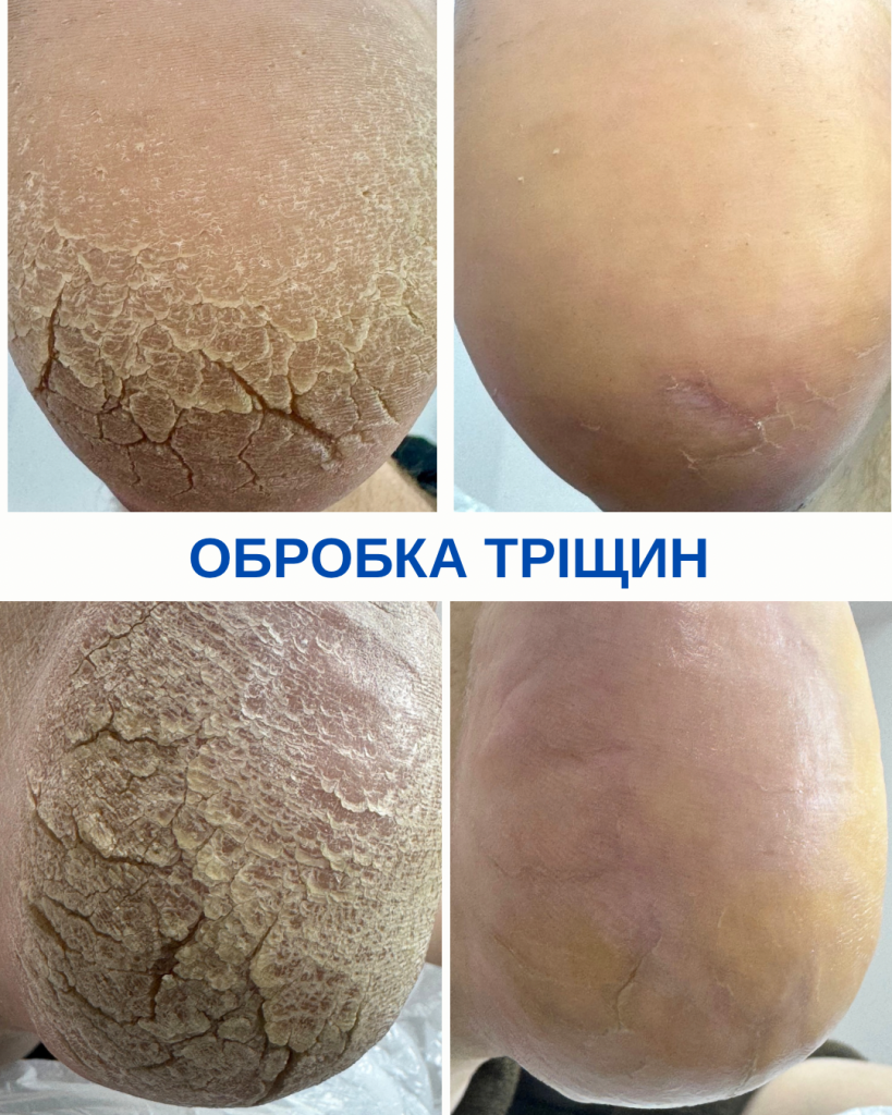 Обробка тріщин
